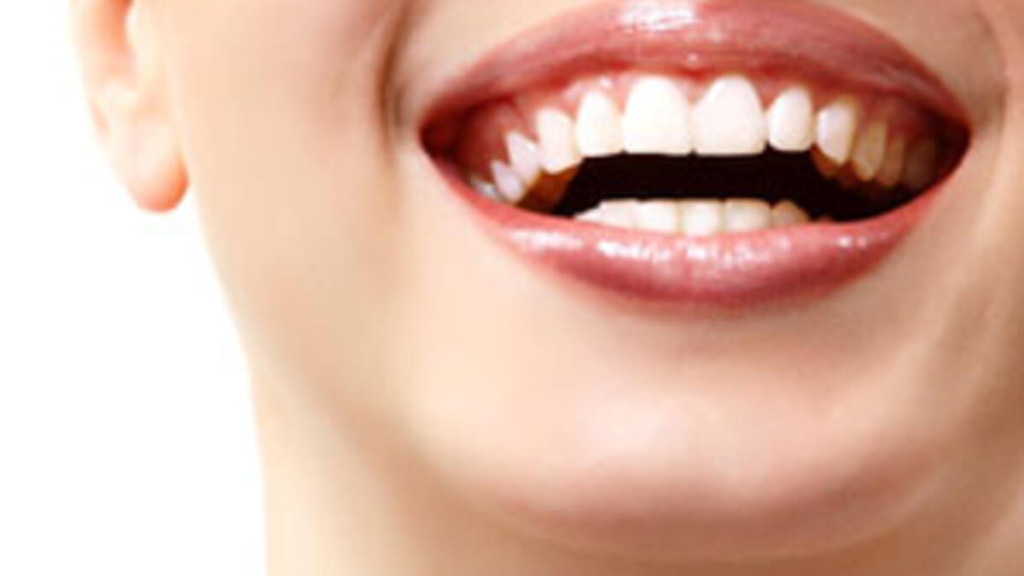 Diş Eti Bakterisi Bakın Hangi Hastalıklara Davetiye Çıkarıyor?