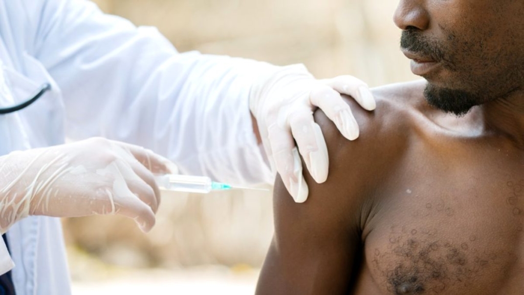 HIV Aşısı Başarısız Olunca Testler Durduruldu